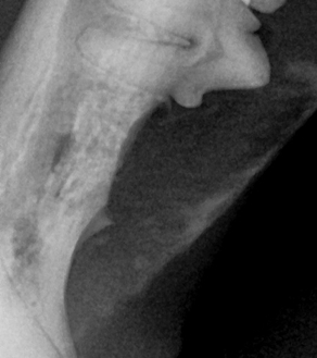 수술케이스 2 after