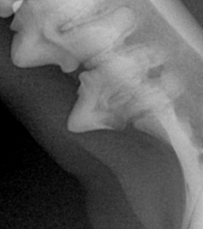 수술케이스 3 before