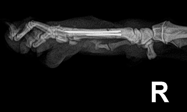 수술케이스 1 after