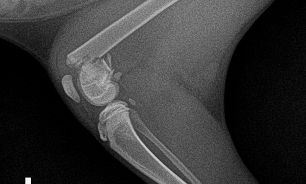 수술케이스 3 before