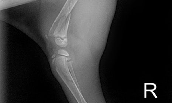 수술케이스 5 before