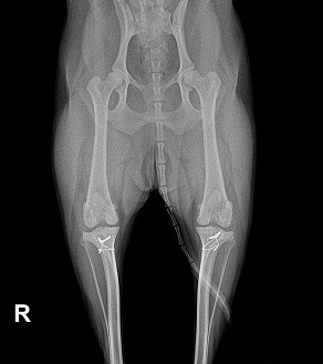 수술케이스 1 after