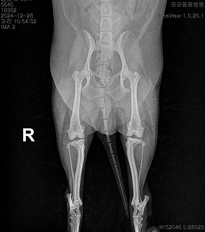 수술케이스 2 before