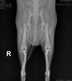 수술케이스 2 after