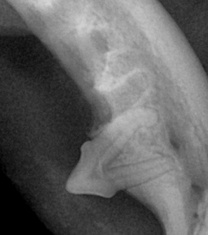 수술케이스 1 after