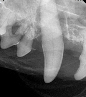 수술케이스 2 before