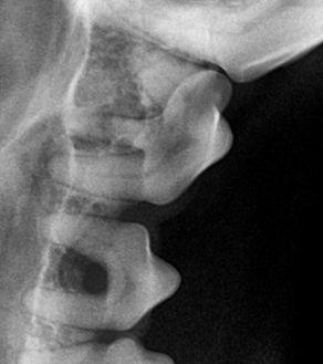 수술케이스 4 before