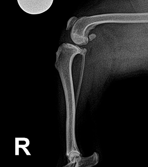 수술케이스 2 before