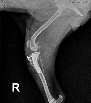 수술케이스 2 after