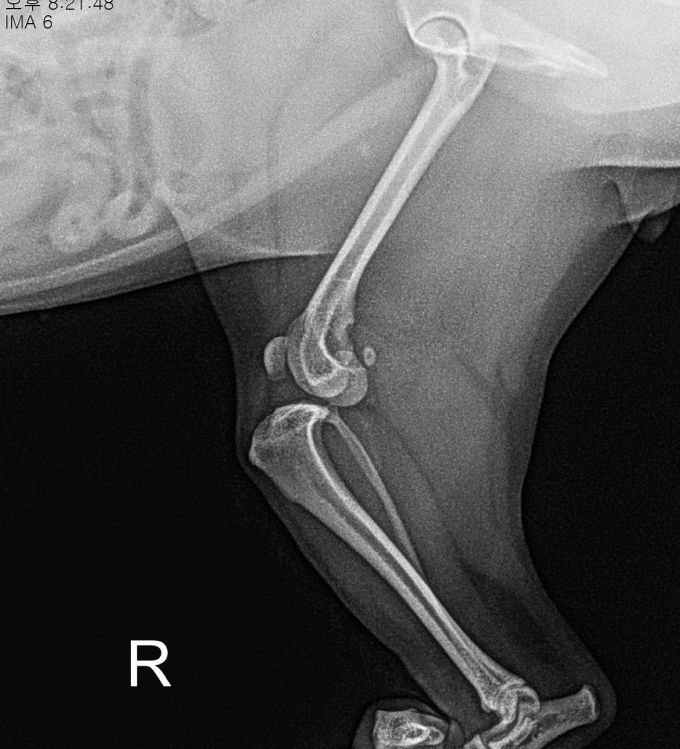 수술케이스 3 before