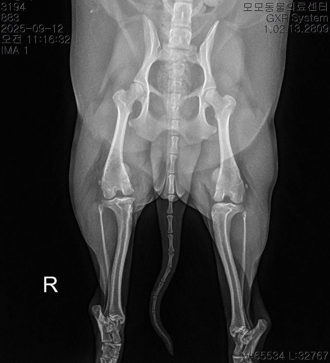 수술케이스 3 before