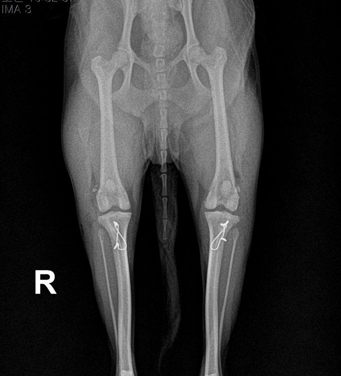 수술케이스 4 after